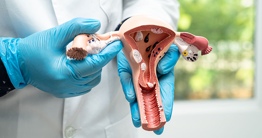 Gynaecological Cancer